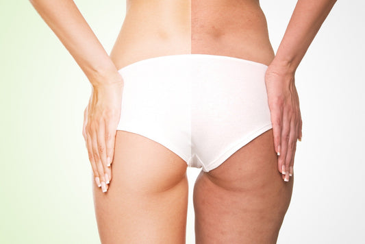 Cellulite & journées assises : le plan 21 jours pour une peau qui paraît plus lisse